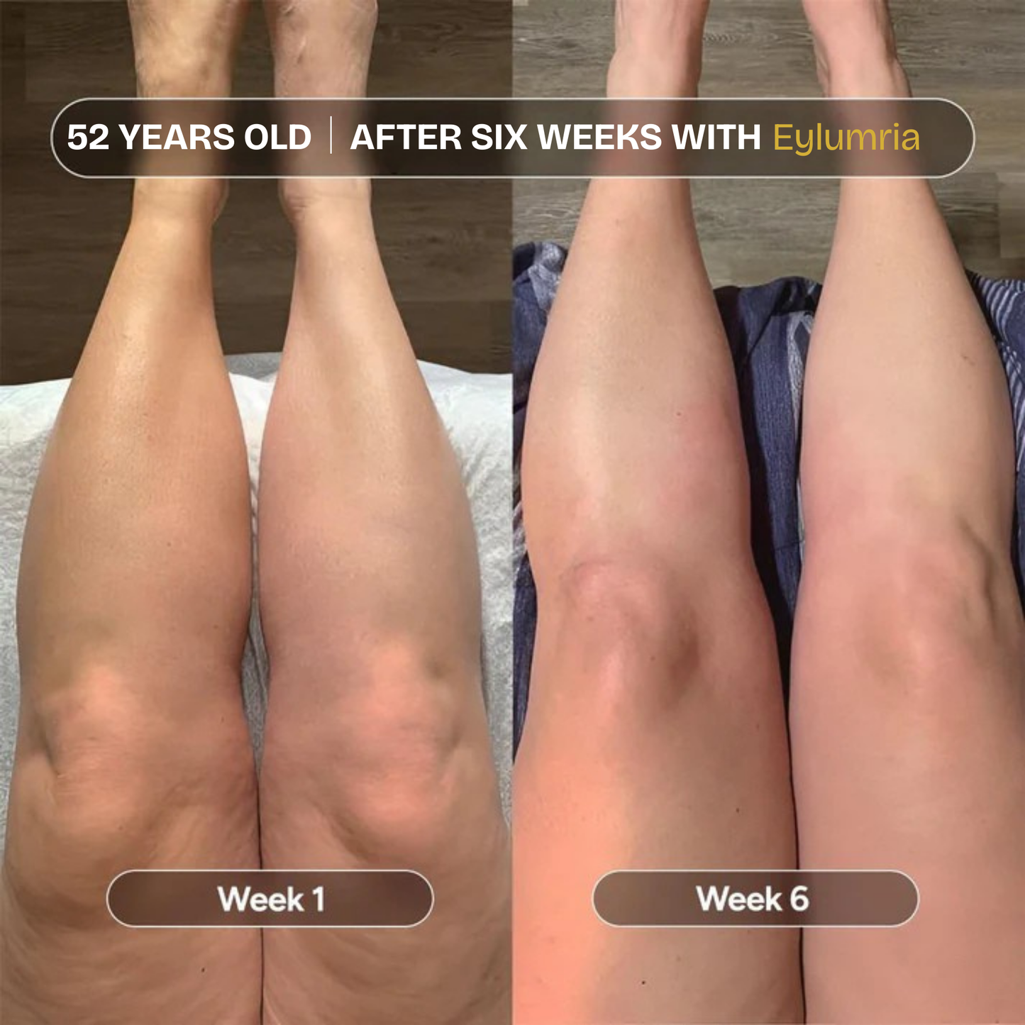 Anti-Cellulite Massage Oil