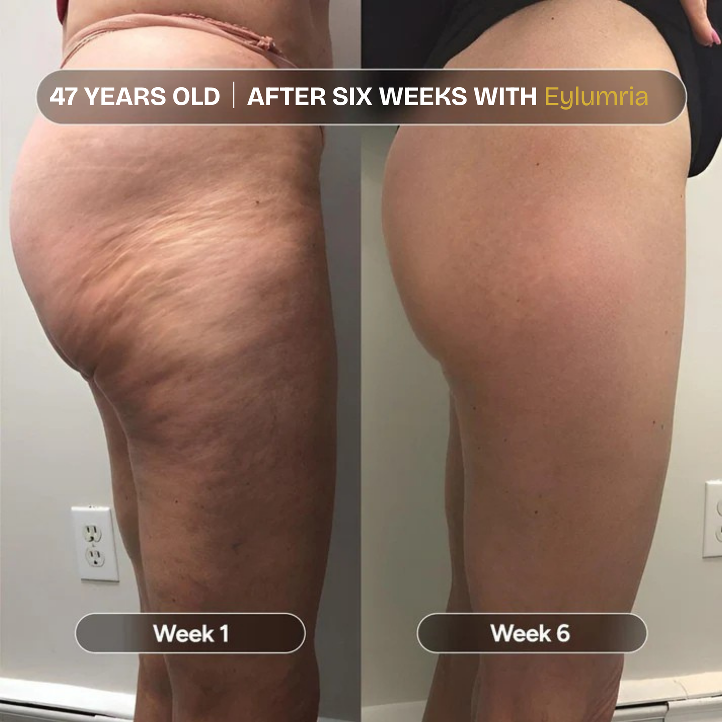 Anti-Cellulite Massage Oil