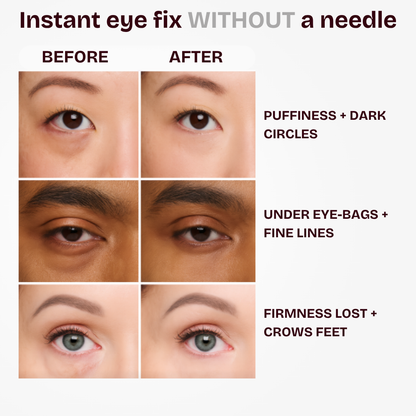 Easy Wear instant Eye Tightener